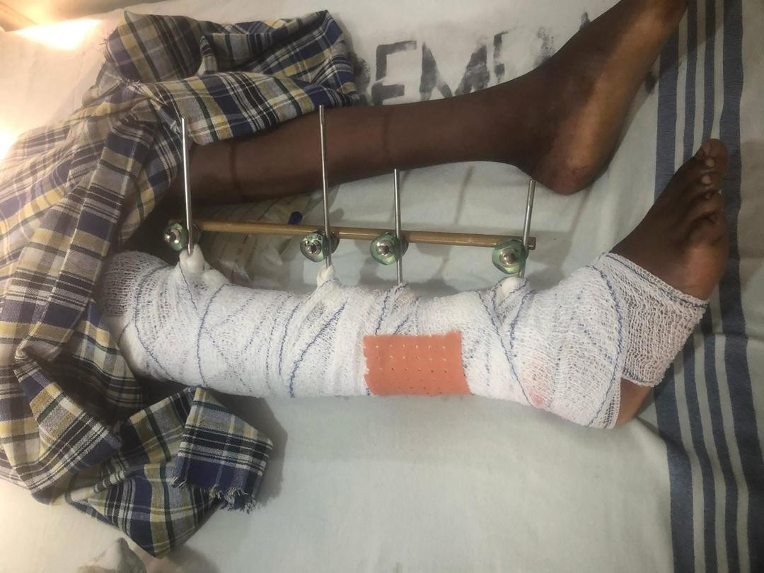 Abuko school drifting accident victim